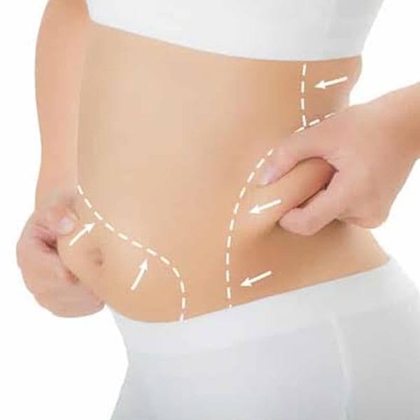 EMF+RF Sculpting Machine - Flanks & Love Handles EMF+RF Sculpting Machine - Buttocks Treatment